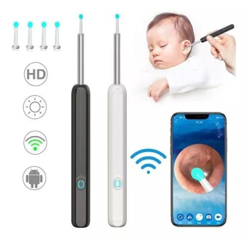 Otoscopio Digital WiFi con Cámara HD y Giroscopio 3 Ejes – Compatible Android/iOS