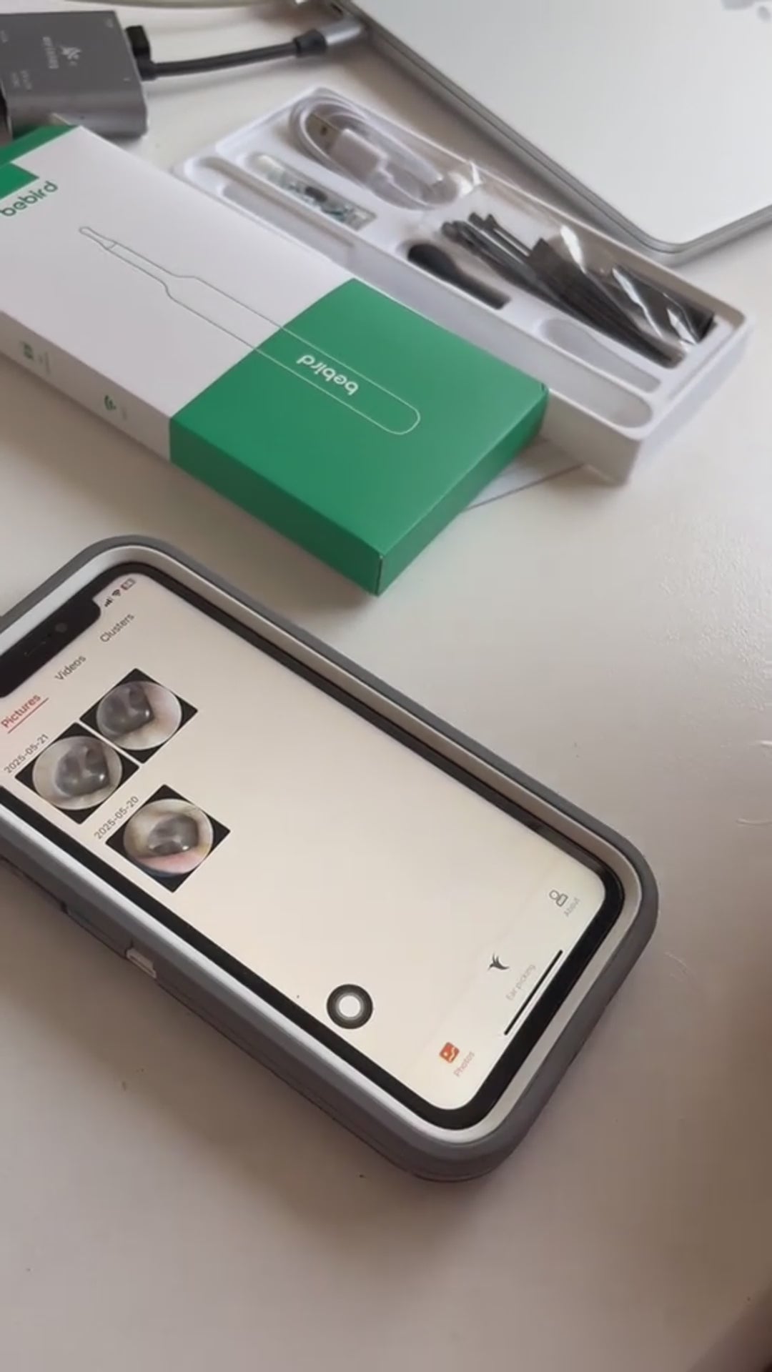 Otoscopio Digital WiFi con Cámara HD y Giroscopio 3 Ejes – Compatible Android/iOS
